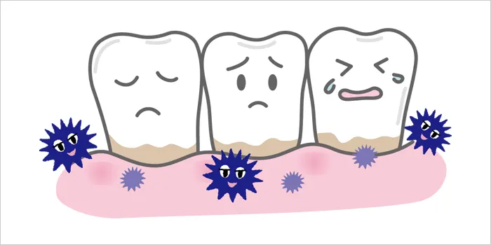 汚れている歯のイラスト