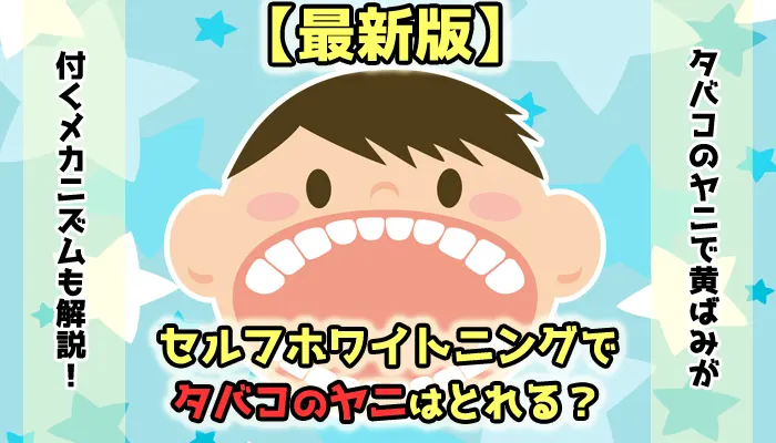 【最新】セルフホワイトニングでタバコのヤニはとれるか徹底解説
